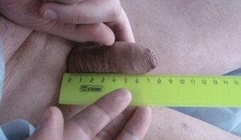 measure penis size